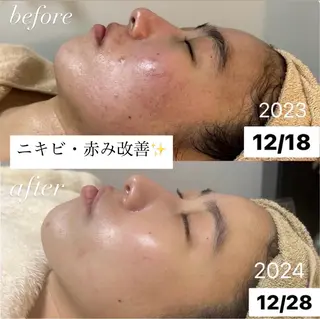 肌質改善専門サロンAte国分寺店所属・Ate Rikaのエステ・リラクイメージ