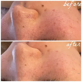 メンズ メナード岐阜市茜部 杉浦のエステ・リラクイメージ