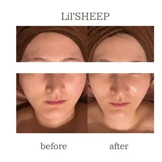 小嶋萌 今池駅徒歩2分のエステ・リラクイメージ