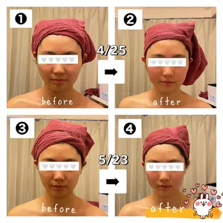 糸島 エステサロンmiuのエステ・リラクイメージ