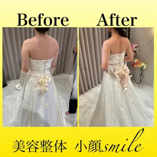 【小顔・姿勢矯正】 美容整体 SMILEのエステ・リラクイメージ