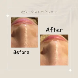 ピーリング専門店 Belluteのエステ・リラクイメージ