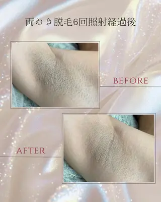 DISINI SPA所属・DISINISPA 脱毛/フェイシャルのエステ・リラクイメージ