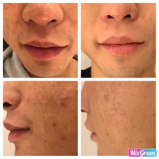 メンズ beauty salon  epのエステ・リラクイメージ