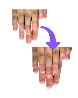 ネイル 深爪矯正専門店ネイルサロンKUU所属・ネイルサロン KUUのネイルデザイン