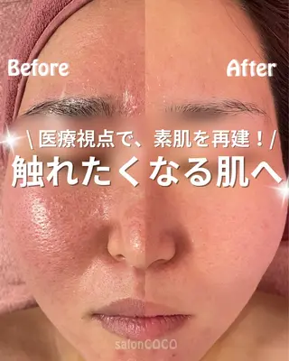 salonCOCO所属・素肌再建看護師💎 salonCOCOのエステ・リラクイメージ