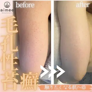 aimee　肌質改善サロン【アイミー】所属・肌質改善サロン aimee｜アイミーのエステ・リラクイメージ