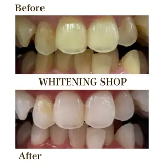 セルフホワイトニングショップ静岡葵区店所属・もえか静岡葵区店ホ ワイトニングショップのその他イメージ