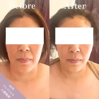 Be-joux 【ビジュー】のエステ・リラクイメージ