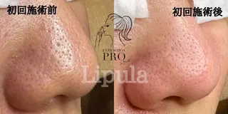 Lipula リプラ所属・毛穴ツヤ肌専門    Lipulaのエステ・リラクイメージ