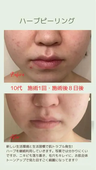 ベラージュ【美背中・ 美尻・フェイシャル】のエステ・リラクイメージ