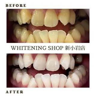 メンズ ホワイトニング ショップ新小岩店のその他イメージ