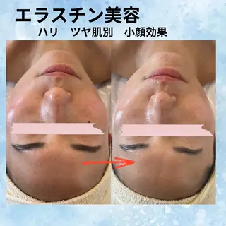 beauty SalonRcoinのマツエク・マツパデザイン