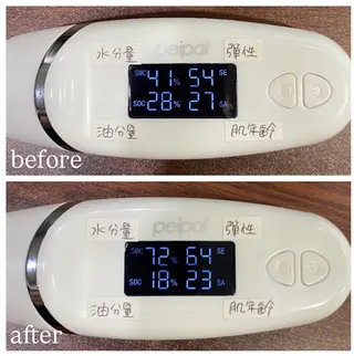 肌質改善専門 ハーブ /毛穴洗浄 リエイトのエステ・リラクイメージ