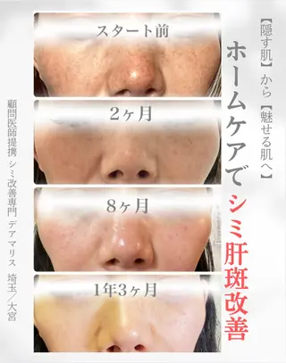 private salon  Dea_maris シュガーリング＆パーソナルボディケア所属・シミ改善・韓国肌管理 ボディメイク痩身のその他イメージ