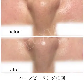 ECXIA 【エクシア】のエステ・リラクイメージ