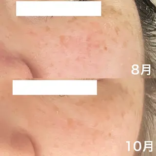 サロンドフルベール 折尾店のエステ・リラクイメージ