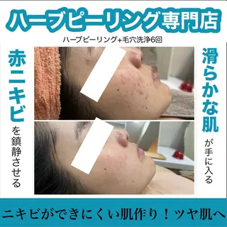 ハーブピーリング専門 muro.のエステ・リラクイメージ