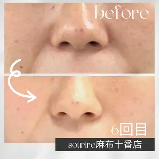 sourire麻布十番店所属・sourire スリールのエステ・リラクイメージ