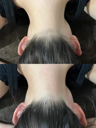 Reine BeautySalon所属・毛穴/シミ肝斑/脱毛 横山梨里のエステ・リラクイメージ