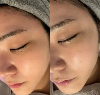 韓国肌管理ララピール クリスタルビューティのエステ・リラクイメージ