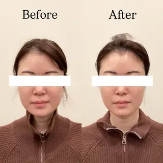 Hari Lounge恵比寿所属・chika🦋 ハリラウンジ恵比寿のエステ・リラクイメージ