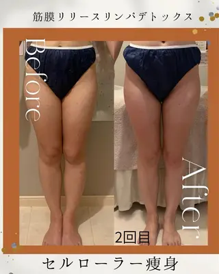 Linné  Yomogi Spa所属・Linné Amiのエステ・リラクイメージ