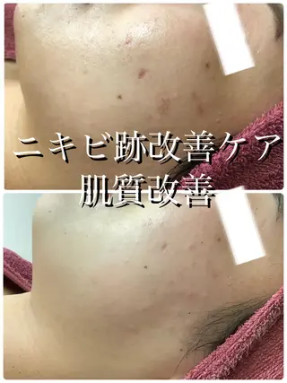 LILIANA所属・LILIANA ☆YURIのエステ・リラクイメージ