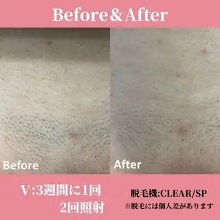 メンズ キッズ 有人型セルフサロン 脱毛／痩身／美顔のエステ・リラクイメージ