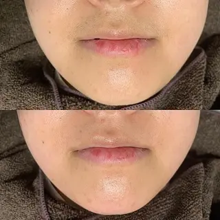 HANASAKURA所属・HANASAKURA 心斎橋のエステ・リラクイメージ