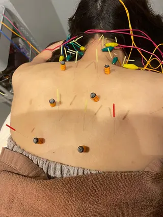 美容鍼灸サロン mahoroba院長のエステ・リラクイメージ