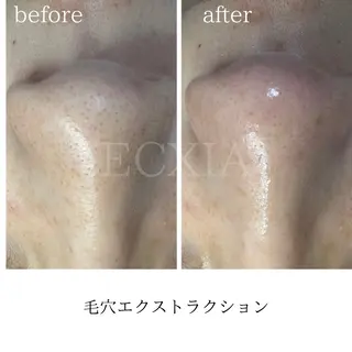 ECXIA 【エクシア】のエステ・リラクイメージ