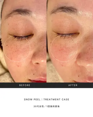 Lani Moon所属・⟡ 京都 小顔  ⊹ Lani Moonのエステ・リラクイメージ