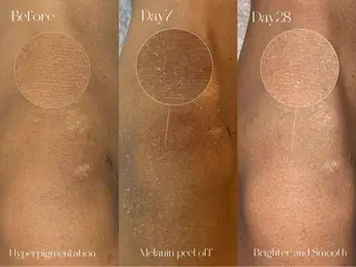 OHAKO塚田 可奈子のその他イメージ