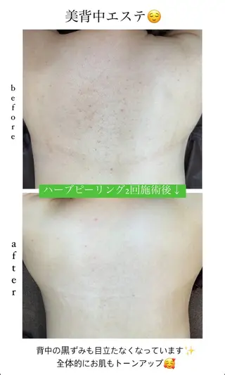 ベラージュ【美背中・ 美尻・フェイシャル】のエステ・リラクイメージ