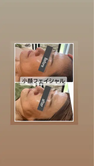 ハーブ/小顔/リンパ /大阪狭山市のエステ・リラクイメージ