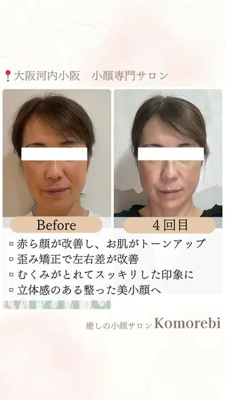 営業電話❌小顔サロン Komorebiのエステ・リラクイメージ