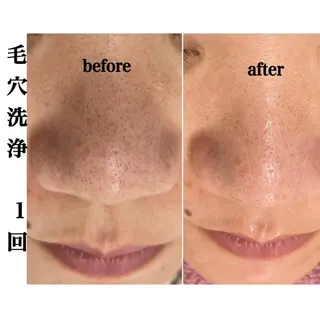 肌ケア&毛穴洗浄 Cheriのエステ・リラクイメージ