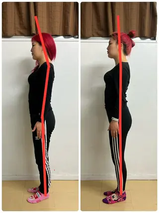 KAKERU 鍼灸整体【慢性痛】のエステ・リラクイメージ