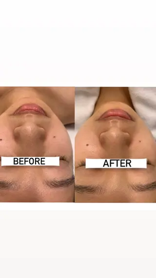 ナリスビューティサロンあべの所属・肌質改善/ツヤ肌作り /松本杏奈のエステ・リラクイメージ