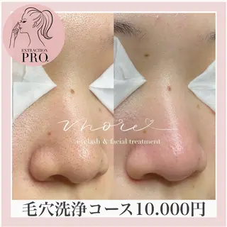 Eyelash salon MORE(モア)所属・安納 麻穂のエステ・リラクイメージ