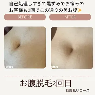 VANILLA SKY所属・VANILLA SKYのエステ・リラクイメージ