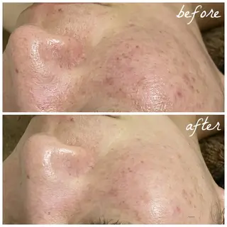 メンズ メナード岐阜茜部 杉浦のエステ・リラクイメージ