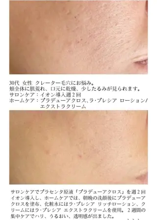 COCORO エステ シユウ ホウのエステ・リラクイメージ