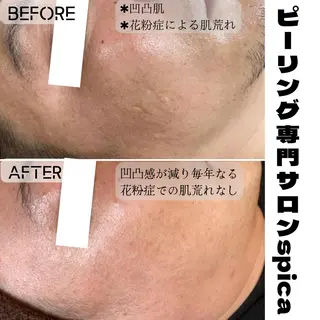 ピーリング専門サロン Spicaのエステ・リラクイメージ