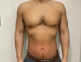 メンズ Mr.Alice所属・脱毛・毛穴洗浄 【Mr.Alice】のエステ・リラクイメージ