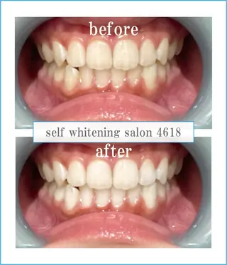self whitening salon 4618所属・ホワイトニングサロン 4618のその他イメージ