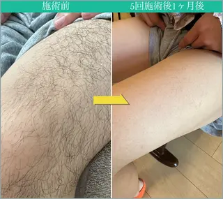 メンズ JONRY所属・JONRY （ジョンリー）のエステ・リラクイメージ