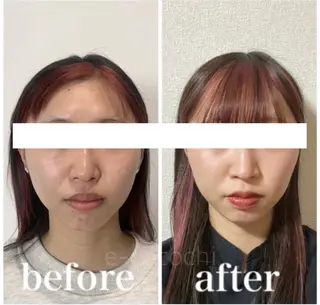 小顔と ヘッドスパのお店のエステ・リラクイメージ