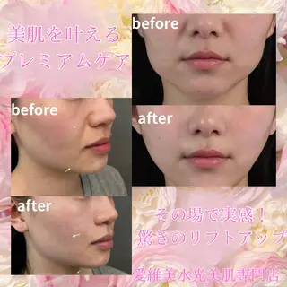 愛維美水光美肌専門店所属・愛維美水光美肌専門店 メンズレディースokのエステ・リラクイメージ